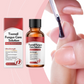 🔥Hete Aanbieding-50%KORTING!🔥🖤Zie Sneller Echte Resultaten🖤2 flesjes Nagelreparatie Essence voor Beschadigde Nagels💅🏻