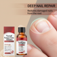 🔥Hete Aanbieding-50%KORTING!🔥🖤Zie Sneller Echte Resultaten🖤2 flesjes Nagelreparatie Essence voor Beschadigde Nagels💅🏻